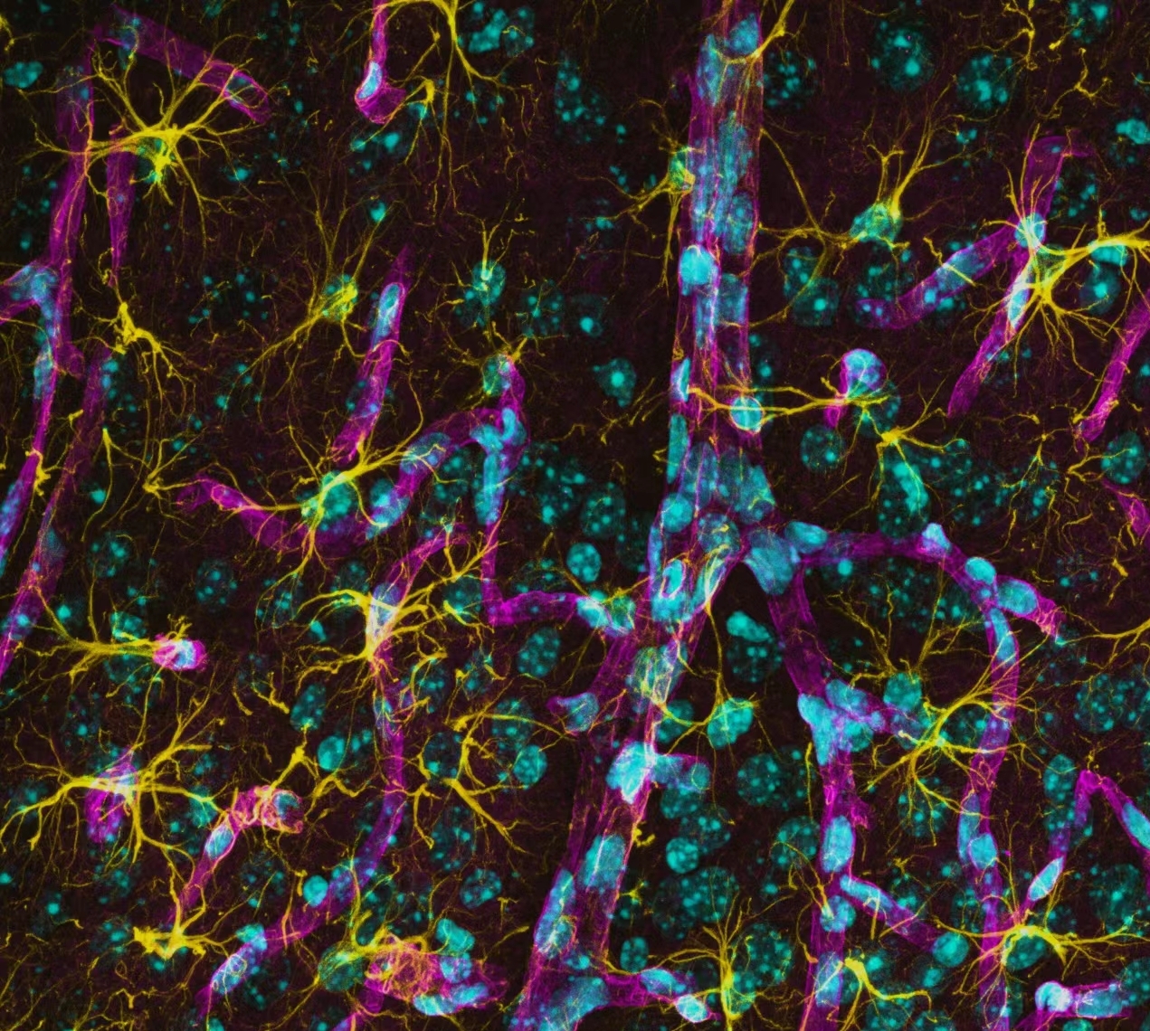 神经元-胶质免疫荧光图片（GFAP、AQP4、Hoechst）